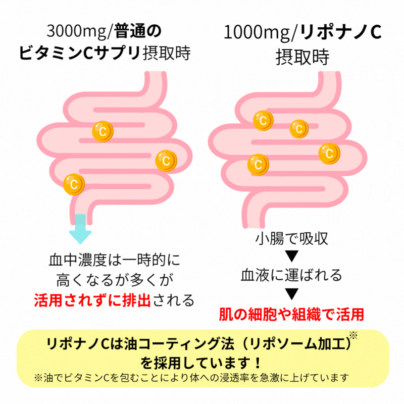 リポソーム型ビタミンCサプリ【LiponanoC】リポナノC 1000mg配合 30包